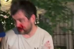 被打到退出刺籍！“邓肯”惨遭纽约暴徒围殴！血流满面脱球衣保命配图