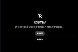 😱露骨！慎入！范德彪小拇指的骨头直接刺出来了！配图